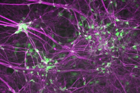 Motor neurons