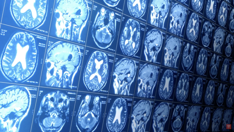 A brain scan from an MRI machine.