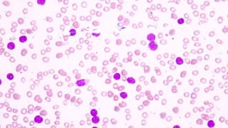 USC researchers find genetic variant contributing to disparities in childhood leukemia risk
