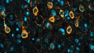 How to clear a toxic protein that can lead to Alzheimer’s and related diseases