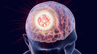 A transparent 3D image of a human head with the brain lit up