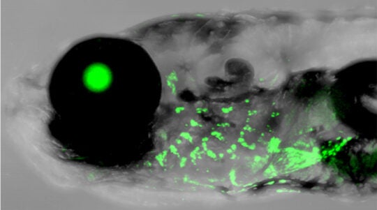 A gene control element for human outer ear development shows activity in the gills (green) of a 2-week old zebrafish
