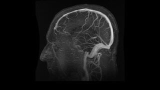 Brain image